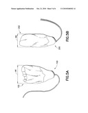 TAMPON PLEDGET WITH IMPROVED BY-PASS LEAKAGE PROTECTION diagram and image