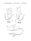 TAMPON PLEDGET WITH IMPROVED BY-PASS LEAKAGE PROTECTION diagram and image