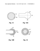 Method of treatment with multi-mode surgical tool diagram and image