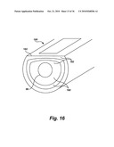 Method of treatment with multi-mode surgical tool diagram and image