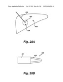 Method of treatment with multi-mode surgical tool diagram and image