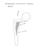 DELIVERY SYSTEMS, TOOLS, AND METHODS OF USE diagram and image