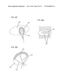 DELIVERY SYSTEMS, TOOLS, AND METHODS OF USE diagram and image