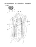 DELIVERY SYSTEMS, TOOLS, AND METHODS OF USE diagram and image