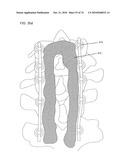 DELIVERY SYSTEMS, TOOLS, AND METHODS OF USE diagram and image