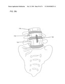 DELIVERY SYSTEMS, TOOLS, AND METHODS OF USE diagram and image