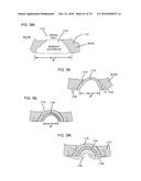 DELIVERY SYSTEMS, TOOLS, AND METHODS OF USE diagram and image