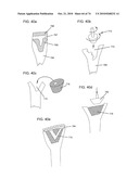 DELIVERY SYSTEMS, TOOLS, AND METHODS OF USE diagram and image