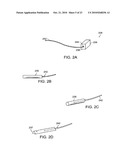 SUTURE PASSER diagram and image