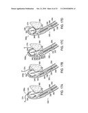 SUTURE PASSER diagram and image