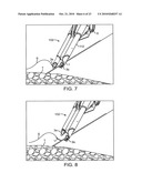 SUTURING DEVICE, SYSTEM, AND METHOD diagram and image