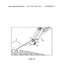 SUTURING DEVICE, SYSTEM, AND METHOD diagram and image