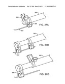 SUTURING DEVICE, SYSTEM, AND METHOD diagram and image