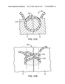 SUTURING DEVICE, SYSTEM, AND METHOD diagram and image