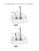 CLAMPS USED FOR INTERCONNECTING A BONE ANCHOR TO A ROD diagram and image