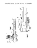 CLAMPS USED FOR INTERCONNECTING A BONE ANCHOR TO A ROD diagram and image