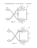 VERTEBRAL ENDPLATE CONNECTION IMPLANT AND METHOD diagram and image