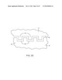 Posterior Spinal Device and Method diagram and image