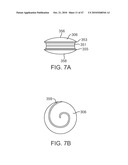 Posterior Spinal Device and Method diagram and image