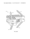 Posterior Spinal Device and Method diagram and image