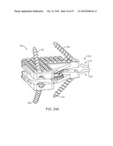 Posterior Spinal Device and Method diagram and image