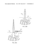 Posterior Spinal Device and Method diagram and image