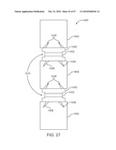 Posterior Spinal Device and Method diagram and image