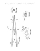 Posterior Spinal Device and Method diagram and image