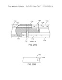 Posterior Spinal Device and Method diagram and image