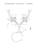 SYSTEM, METHOD AND APPARATUS FOR REMOVAL OF VOLATILE ANESTHETICS FOR MALIGNANT HYPERTHERMIA diagram and image