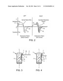 Systems, methods and apparatus for respiratory support of a patient diagram and image