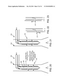 Systems, methods and apparatus for respiratory support of a patient diagram and image