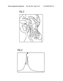 METHOD FOR IMAGING IN MAGNETIC RESONANCE TOMOGRAPHY WITH SPECTRAL FAT SATURATION OR SPECTRAL WATER EXCITATION diagram and image