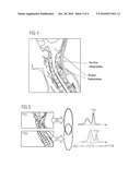 METHOD FOR IMAGING IN MAGNETIC RESONANCE TOMOGRAPHY WITH SPECTRAL FAT SATURATION OR SPECTRAL WATER EXCITATION diagram and image