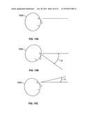 ELECTRONIC EYEGLASS FRAME diagram and image