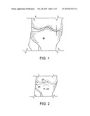 Method and System for Characterization of Knee Joint Morphology diagram and image