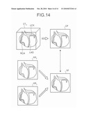 IMAGE DISPLAY APPARATUS AND X-RAY DIAGNOSIS APPARATUS diagram and image