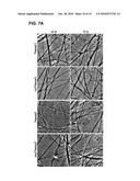 METHODS AND COMPOSITIONS FOR TREATING NEUROPATHIES diagram and image