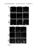 AMETHOD OF TREATING NEURODEGENERATIVE DISEASES diagram and image