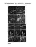 AMETHOD OF TREATING NEURODEGENERATIVE DISEASES diagram and image