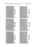 ENDOPROSTHESE diagram and image