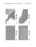 ENDOPROSTHESE diagram and image