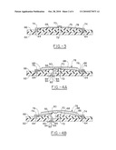 Fluid Regulating Microvalve Assembly For Fluid Consuming Cells diagram and image