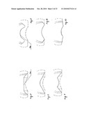 STEADY PRESSURE DENTAL IMPRESSION TRAY AND THE IDEA OF OPERATION diagram and image