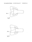 STEADY PRESSURE DENTAL IMPRESSION TRAY AND THE IDEA OF OPERATION diagram and image