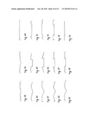 STEADY PRESSURE DENTAL IMPRESSION TRAY AND THE IDEA OF OPERATION diagram and image