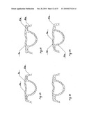 STEADY PRESSURE DENTAL IMPRESSION TRAY AND THE IDEA OF OPERATION diagram and image