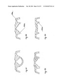 STEADY PRESSURE DENTAL IMPRESSION TRAY AND THE IDEA OF OPERATION diagram and image