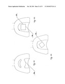 STEADY PRESSURE DENTAL IMPRESSION TRAY AND THE IDEA OF OPERATION diagram and image