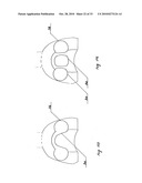 STEADY PRESSURE DENTAL IMPRESSION TRAY AND THE IDEA OF OPERATION diagram and image